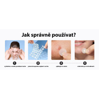 Wellife Náplasti na akné transparentní 180 ks